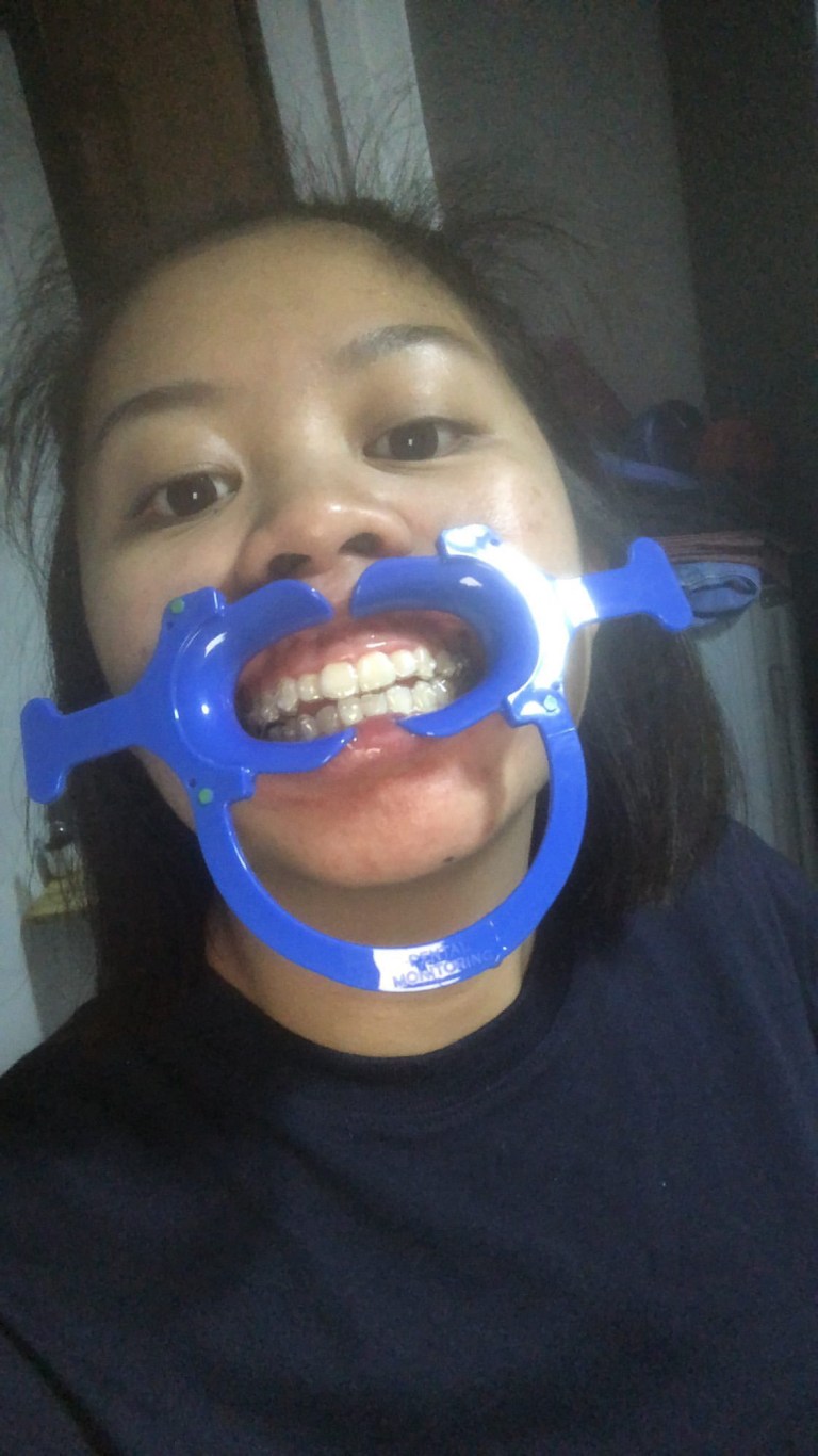 CA226AF4-1DBB-4B57-BD28-C77E3F24F547